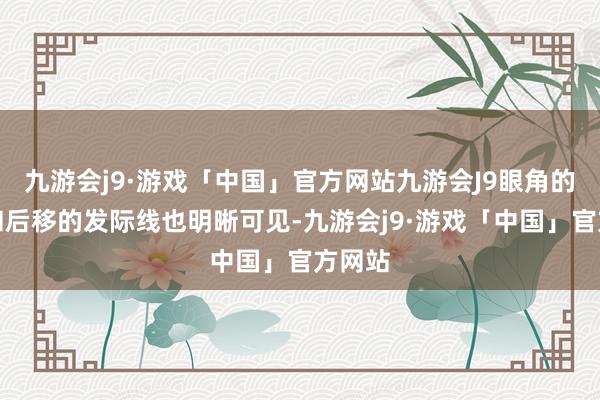 九游会j9·游戏「中国」官方网站九游会J9眼角的皱纹和后移的发际线也明晰可见-九游会j9·游戏「中国」官方网站